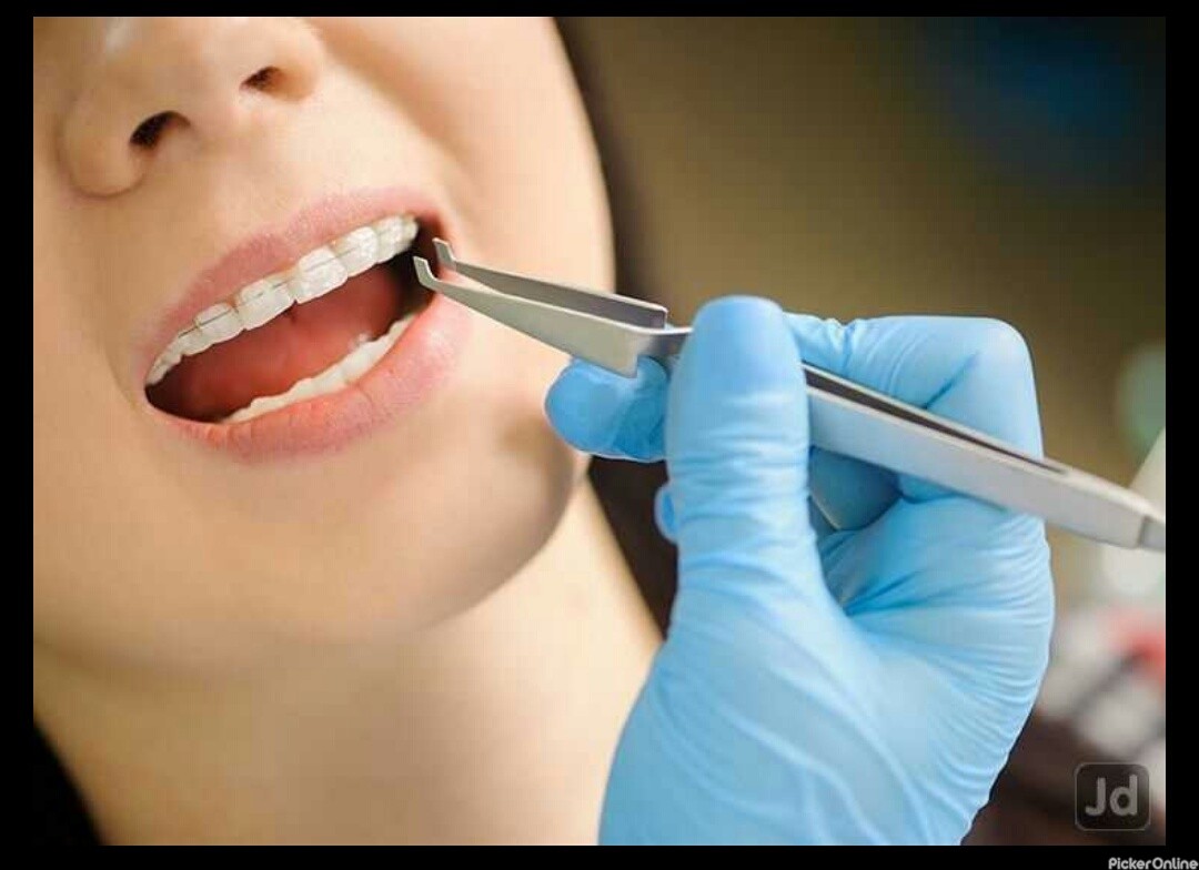 Bright Smile Dental Care Bajaj Nagar Nagpur